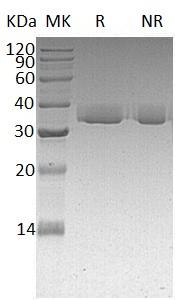 Human LGALS3/MAC2 (His tag) recombinant protein