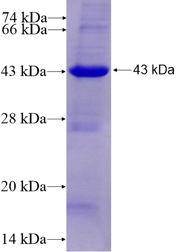 Recombinant Human KIAA1199 SDS-PAGE