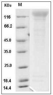 Mouse CD96 Protein (His Tag) SDS-PAGE