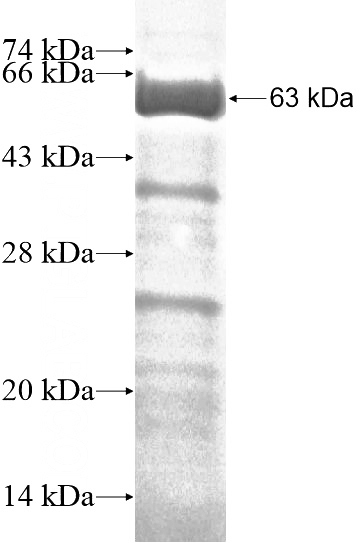 Recombinant Human LRCH1 SDS-PAGE