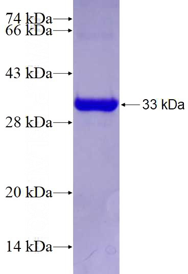 Recombinant Human GDAP1 SDS-PAGE