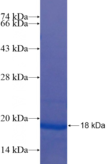 Recombinant Human BIVM SDS-PAGE