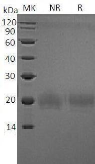 Mouse Icos/Ailim (His tag) recombinant protein
