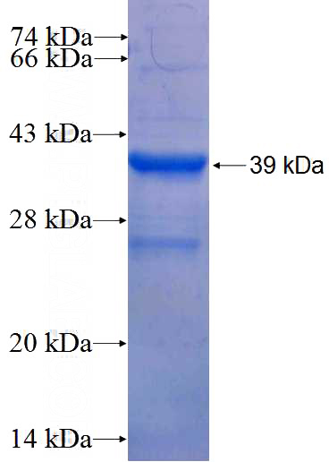 Recombinant Human ITGB1BP3 SDS-PAGE