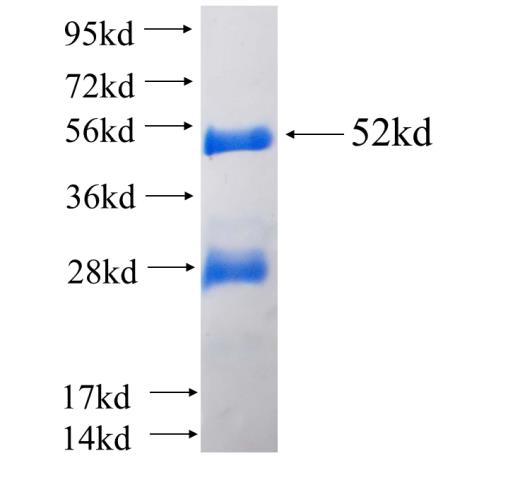Recombinant human RTN3 SDS-PAGE