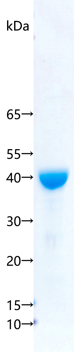Recombinant Arabidopsis thaliana REF6 SDS-PAGE