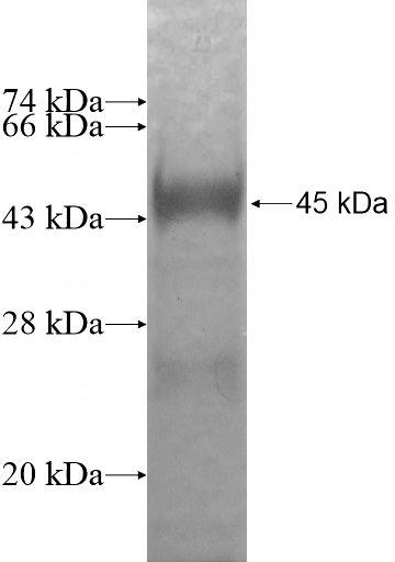 Recombinant Human TBC1D15 SDS-PAGE