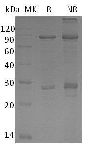 Human SMAD1/BSP1/MADH1/MADR1 (GST tag) recombinant protein