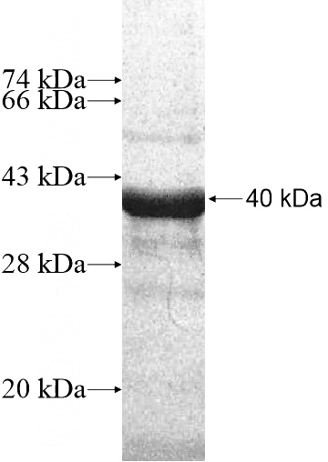 Recombinant Human KIF19 SDS-PAGE