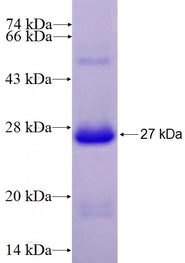 Recombinant Human TLR10 SDS-PAGE