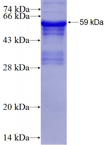 Recombinant Human SCRN2 SDS-PAGE