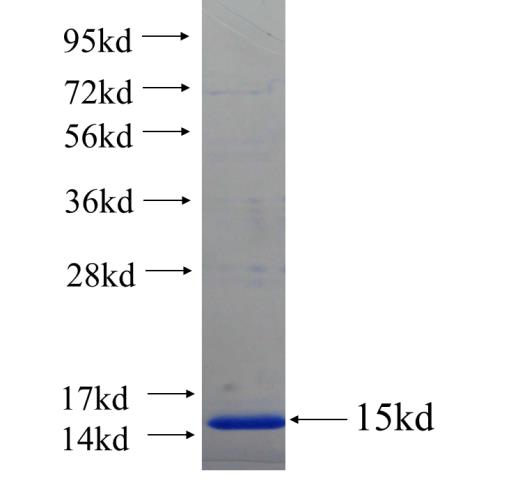 Recombinant human ZNF140 SDS-PAGE