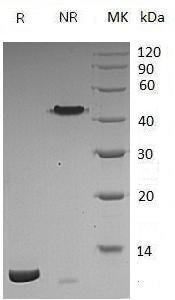 Human CER1/DAND4 (His tag) recombinant protein
