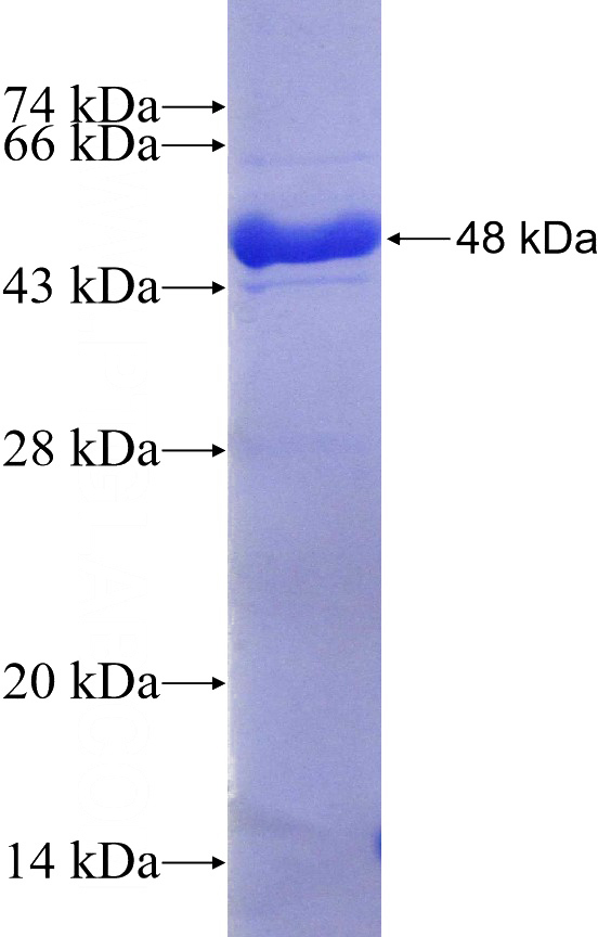 Recombinant Human KCTD14 SDS-PAGE