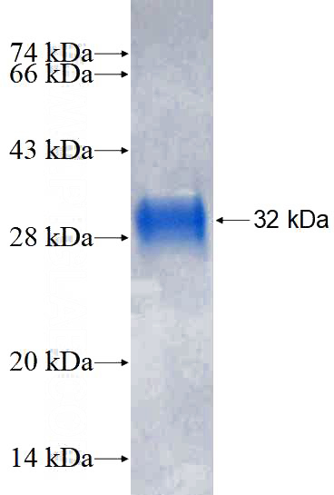 Recombinant Human ATP6V1G2 SDS-PAGE