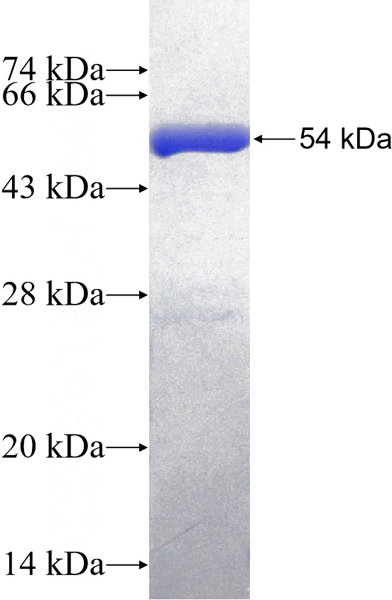 Recombinant Human NANP SDS-PAGE