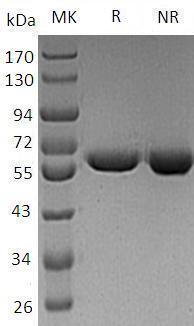 Human WARS/IFI53/WRS (His tag) recombinant protein