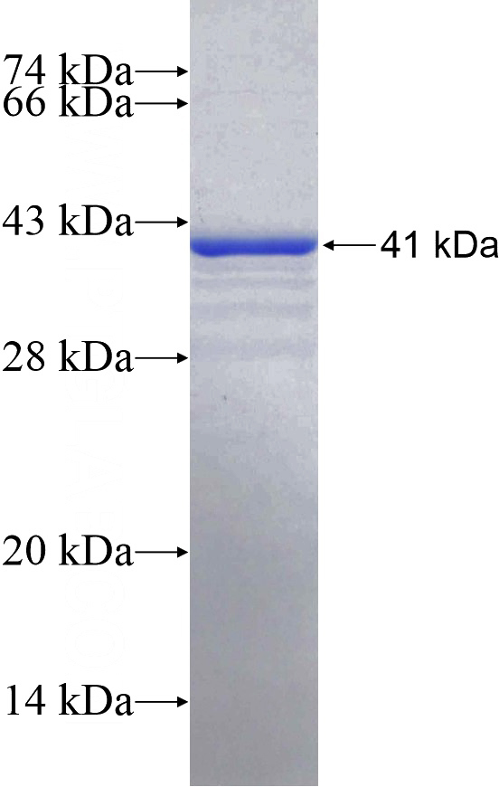 Recombinant Human NMDAR2A/GRIN2A SDS-PAGE