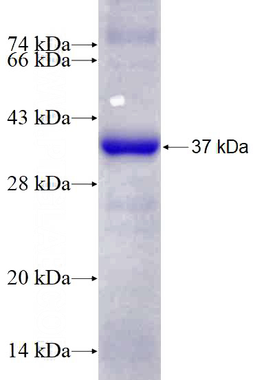 Recombinant Human MAP3K9 SDS-PAGE