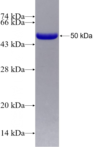 Recombinant Human SMARCA2-Specific SDS-PAGE