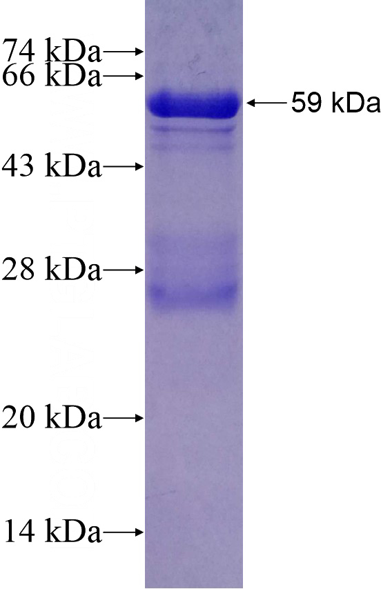 Recombinant Human B3GALTL SDS-PAGE