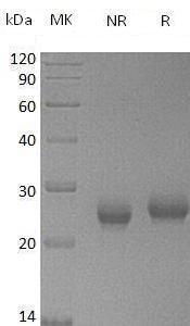 Mouse Timp1/Timp/Timp-1 recombinant protein