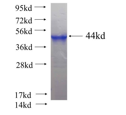 Recombinant human UBR7 SDS-PAGE