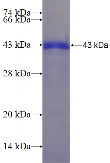 Recombinant Human ITPRIP SDS-PAGE