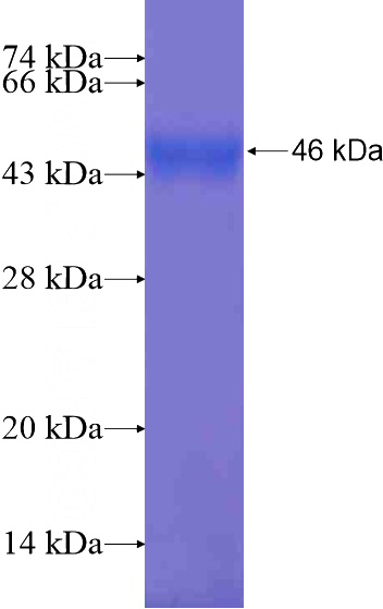 Recombinant Human NLRP10 SDS-PAGE