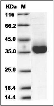 Cynomolgus / Rhesus PD-L1 / B7-H1 / CD274 Protein (His Tag) SDS-PAGE