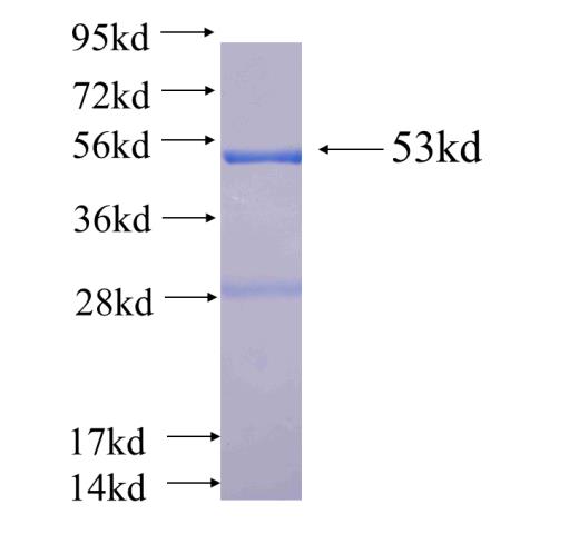 Recombinant human THEM4(Full length) SDS-PAGE