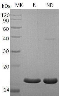 Human AGR3/BCMP11/PDIA18/UNQ642/PRO1272 (His tag) recombinant protein