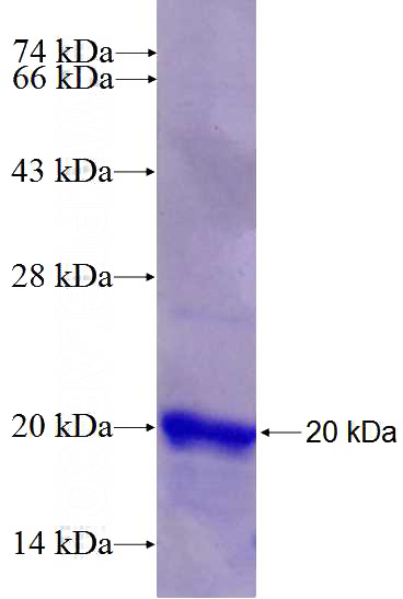 Recombinant Human PLEKHN1 SDS-PAGE