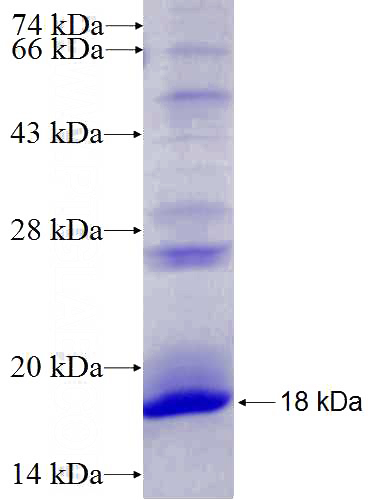 Recombinant Human EGLN3 SDS-PAGE