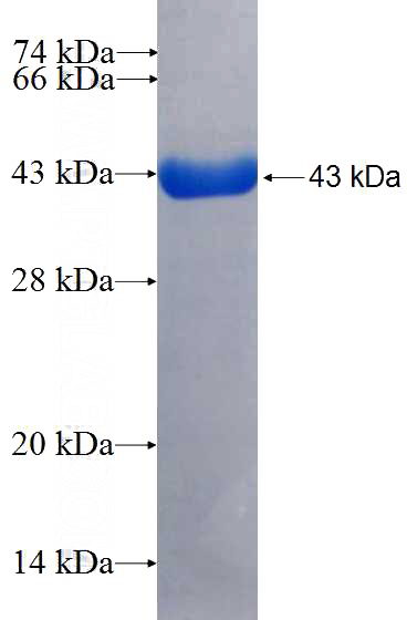 Recombinant Human TXNIP SDS-PAGE