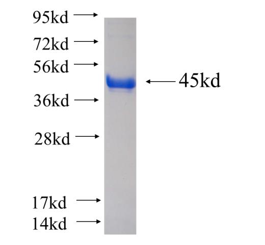 Recombinant human CNNM3 SDS-PAGE