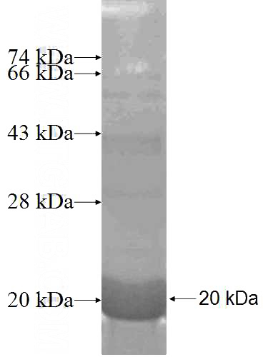 Recombinant Human SNRPD2 SDS-PAGE