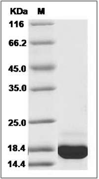 Human PFDN1 Protein (His Tag) SDS-PAGE