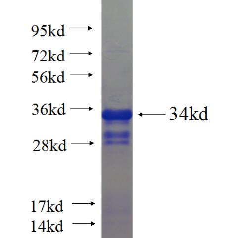 Recombinant human POU3F2 SDS-PAGE