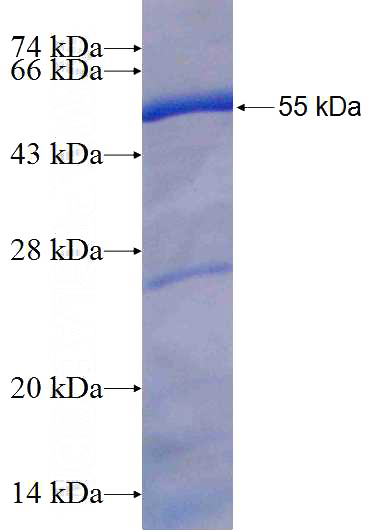 Recombinant Human LETM1 SDS-PAGE