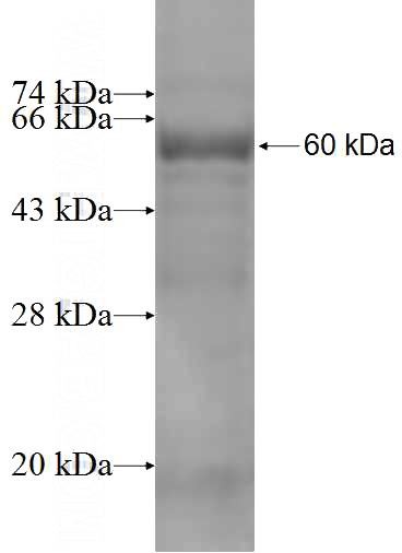 Recombinant Human BBS4 SDS-PAGE
