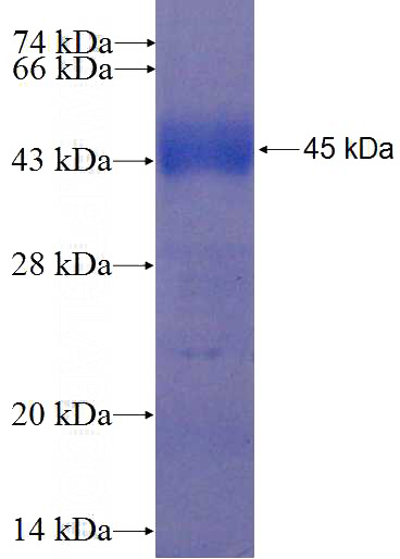 Recombinant Human EYS SDS-PAGE