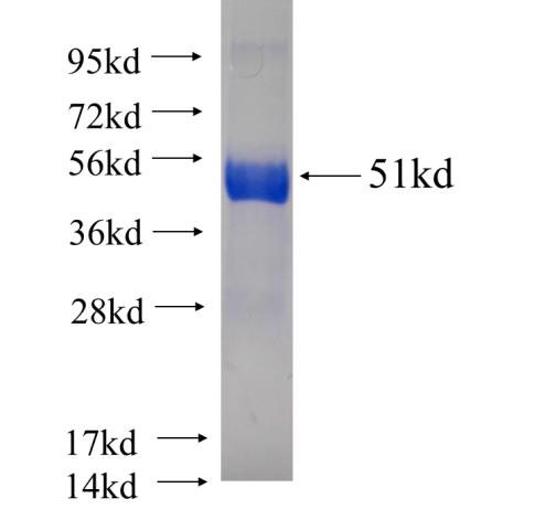 Recombinant human RAB39(Full length) SDS-PAGE