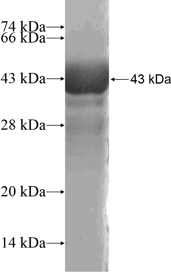 Recombinant Human DOC2B SDS-PAGE