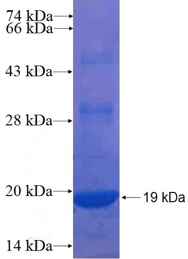 Recombinant Human ANKRD16 SDS-PAGE