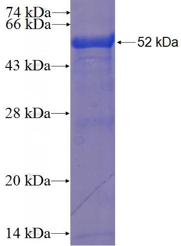 Recombinant Human RNF141 SDS-PAGE