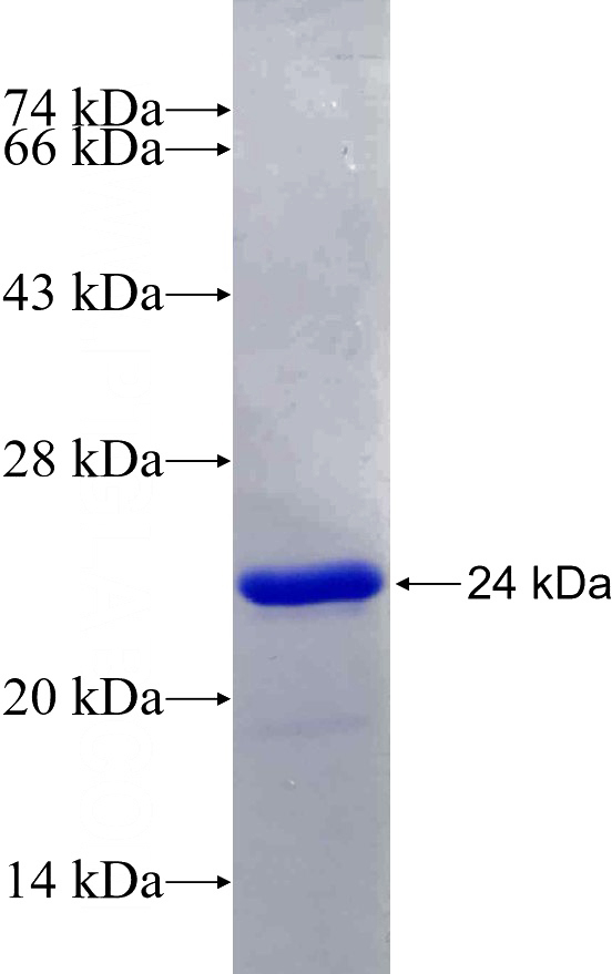 Recombinant Human CAPS SDS-PAGE