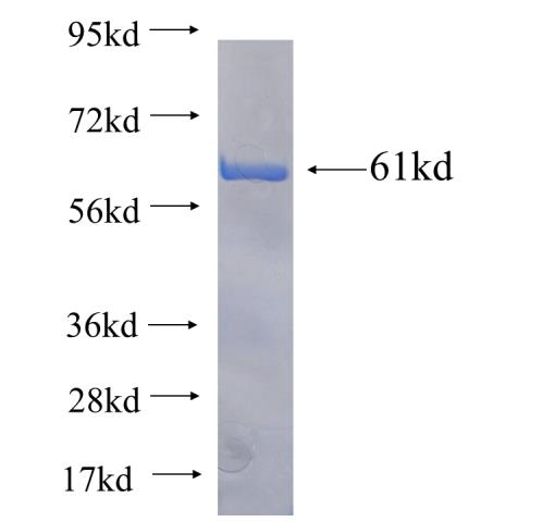 Recombinant human ITPKA SDS-PAGE