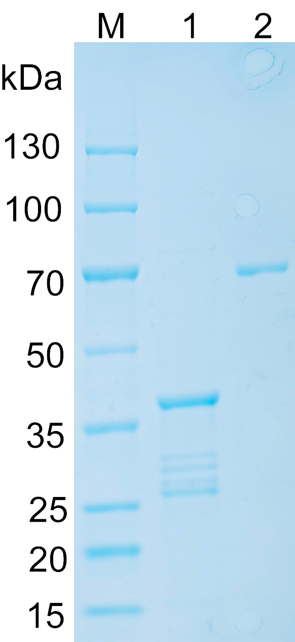 Recombinant human SLC5A7 SDS-PAGE