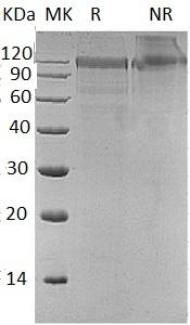 Human MASP1/CRARF/CRARF1/PRSS5 (His tag) recombinant protein